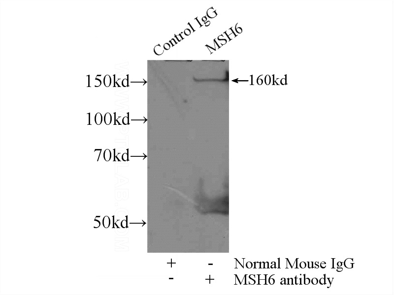 IP Result of anti-MSH6 (IP:Catalog No:107431, 4ug; Detection:Catalog No:107431 1:600) with HEK-293 cells lysate 1800ug.