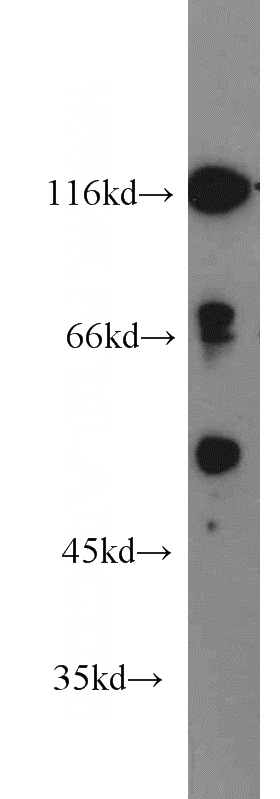 mouse pancreas tissue were subjected to SDS PAGE followed by western blot with Catalog No:110207(EFHA1 antibody) at dilution of 1:800