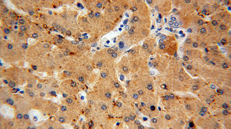 Immunohistochemical of paraffin-embedded human liver using Catalog No:112522(METTL7B antibody) at dilution of 1:100 (under 40x lens)
