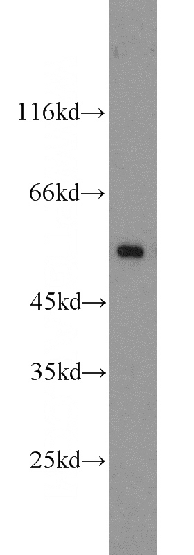 mouse heart tissue were subjected to SDS PAGE followed by western blot with Catalog No:109897(DES antibody) at dilution of 1:4000