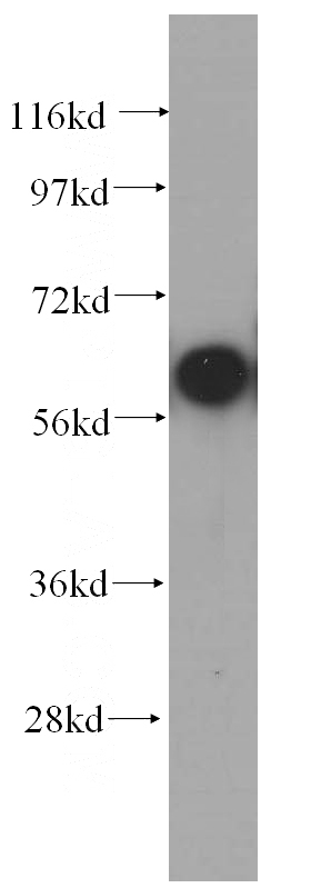 HeLa cells were subjected to SDS PAGE followed by western blot with Catalog No:109364(COASY antibody) at dilution of 1:500