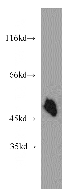 mouse brain tissue were subjected to SDS PAGE followed by western blot with Catalog No:115773(SYT12 antibody) at dilution of 1:500