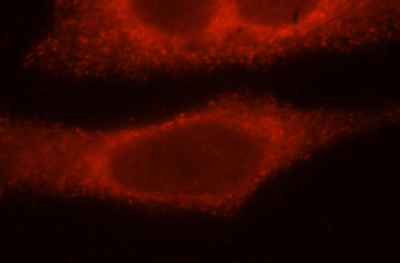 Immunofluorescent analysis of Hela cells, using AP2B1 antibody Catalog No:108120 at 1:25 dilution and Rhodamine-labeled goat anti-rabbit IgG (red).