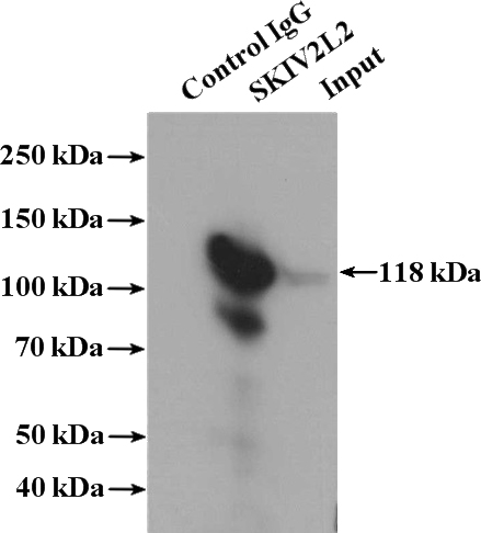 IP Result of anti-SKIV2L2 (IP:Catalog No:115288, 4ug; Detection:Catalog No:115288 1:300) with mouse testis tissue lysate 4000ug.