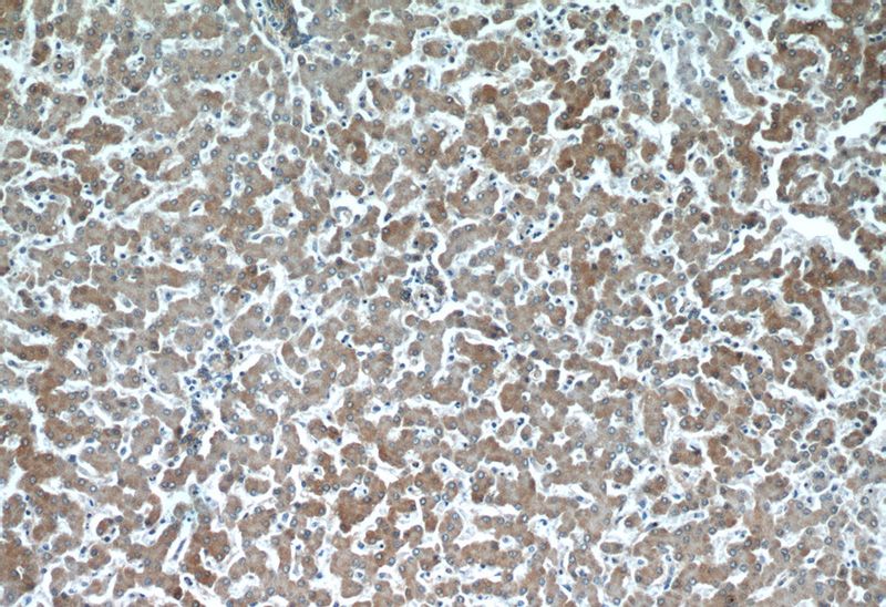 Immunohistochemical of paraffin-embedded human liver using Catalog No:115196(SERPINA10 antibody) at dilution of 1:100 (under 10x lens)