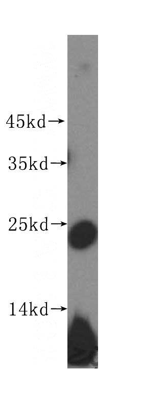 mouse thymus tissue were subjected to SDS PAGE followed by western blot with Catalog No:114809(RPL10 antibody) at dilution of 1:500