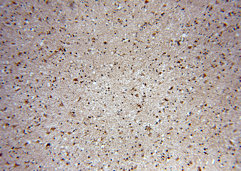 Immunohistochemical of paraffin-embedded human brain using Catalog No:111440(HOXD13 antibody) at dilution of 1:100 (under 10x lens)