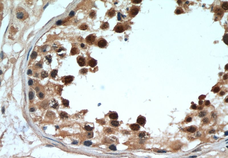 Immunohistochemical of paraffin-embedded human testis using Catalog No:109828(DDX39 antibody) at dilution of 1:50 (under 40x lens)