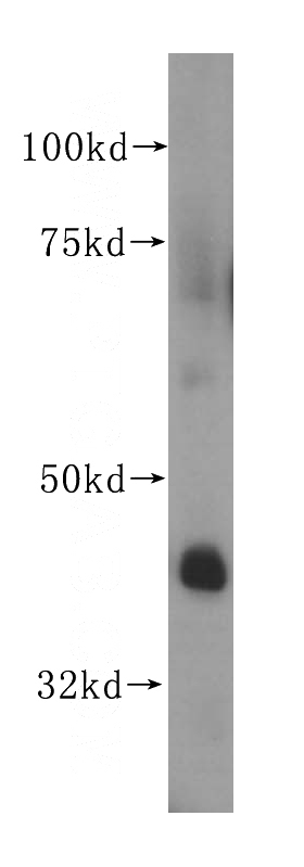 human heart tissue were subjected to SDS PAGE followed by western blot with Catalog No:109769(DDAH2 antibody) at dilution of 1:500
