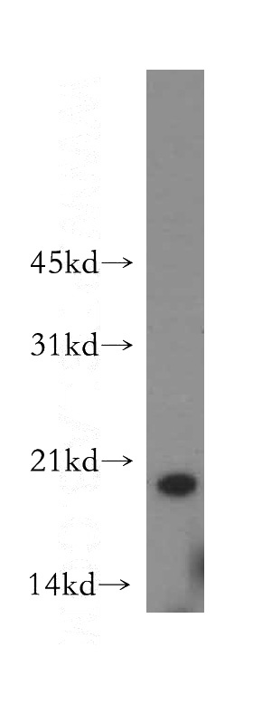 HeLa cells were subjected to SDS PAGE followed by western blot with Catalog No:113351(OPA3 antibody) at dilution of 1:400
