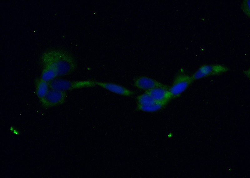 Immunofluorescent analysis of (-20oc Ethanol) fixed A431 cells using Catalog No:114111(PPP3CB Antibody) at dilution of 1:25 and Alexa Fluor 488-congugated AffiniPure Goat Anti-Rabbit IgG(H+L)