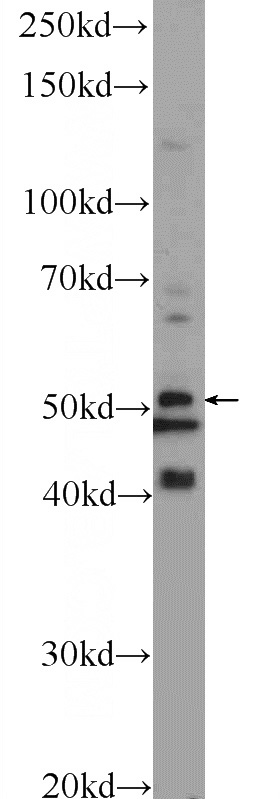 L02 cells were subjected to SDS PAGE followed by western blot with Catalog No:116222(TPTE2 Antibody) at dilution of 1:300