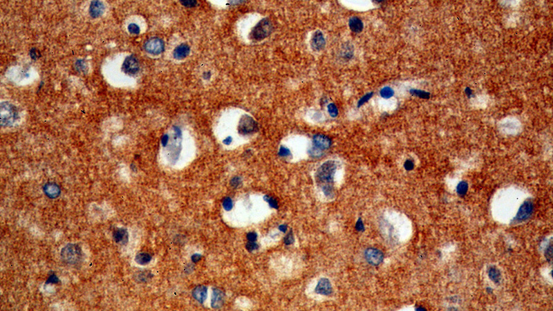 Immunohistochemical of paraffin-embedded human brain using Catalog No:109511(CPLX2 antibody) at dilution of 1:100 (under 40x lens)