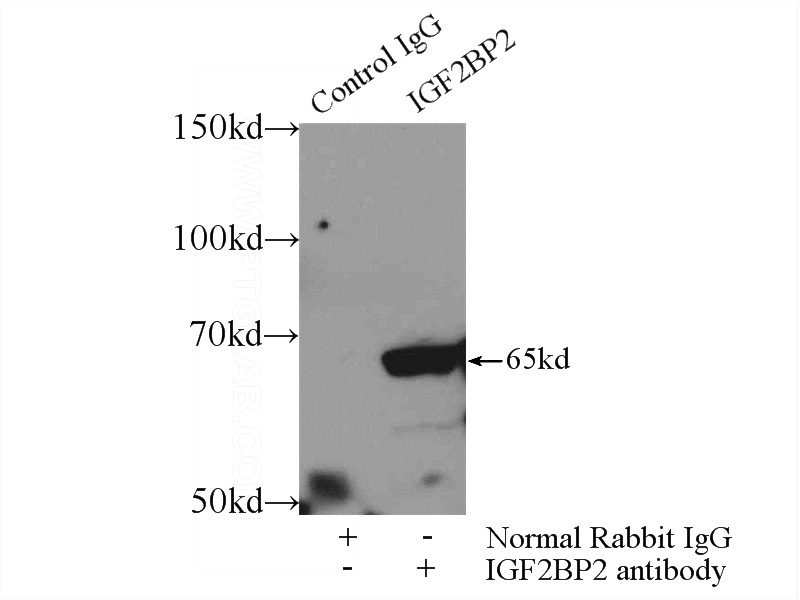 IP Result of anti-IGF2BP2 (IP:Catalog No:111680, 3ug; Detection:Catalog No:111680 1:500) with HEK-293 cells lysate 1000ug.