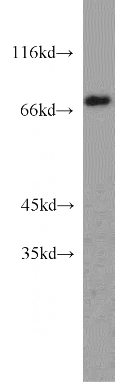 A431 cells were subjected to SDS PAGE followed by western blot with Catalog No:113558(TP63 antibody) at dilution of 1:1000