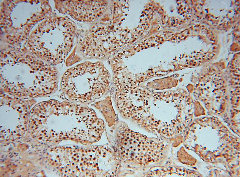 Immunohistochemical of paraffin-embedded human testis using Catalog No:108258(ADPRHL2 antibody) at dilution of 1:100 (under 10x lens)
