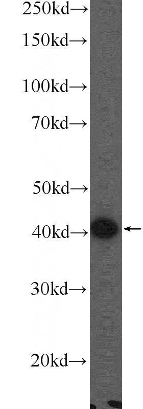 COLO 320 cells were subjected to SDS PAGE followed by western blot with Catalog No:112484(MARVELD3 Antibody) at dilution of 1:1000