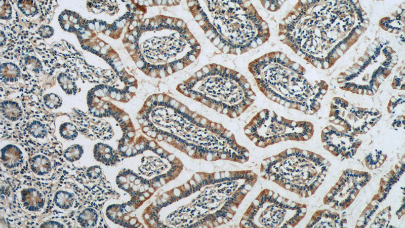 Immunohistochemistry of paraffin-embedded human small intestine tissue slide using Catalog No:114161(PPYR1 Antibody) at dilution of 1:50 (under 10x lens)