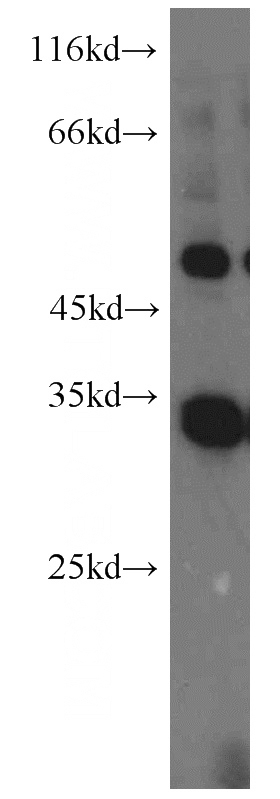 MDA-MB-453s cells were subjected to SDS PAGE followed by western blot with Catalog No:113732(PEX7 antibody) at dilution of 1:800