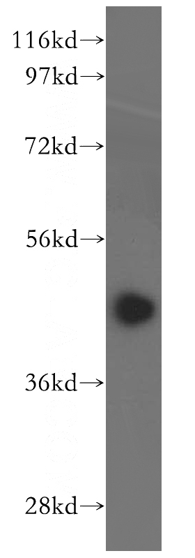 human kidney tissue were subjected to SDS PAGE followed by western blot with Catalog No:111794(ING3-specific antibody) at dilution of 1:500