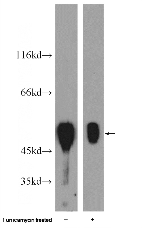 Tunicamycin treated HepG2 cells were subjected to SDS PAGE followed by western blot with Catalog No:116985(XIAP Antibody) at dilution of 1:600