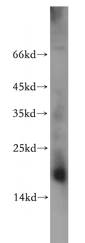 mouse kidney tissue were subjected to SDS PAGE followed by western blot with Catalog No:113247(NME2 antibody) at dilution of 1:200