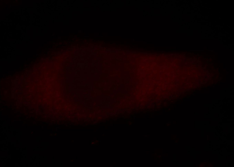Immunofluorescent analysis of Hela cells, using USP10 antibody Catalog No:116586 at 1:25 dilution and Rhodamine-labeled goat anti-rabbit IgG (red).