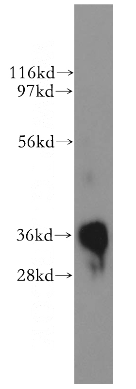 human skeletal muscle tissue were subjected to SDS PAGE followed by western blot with Catalog No:114012(PLSCR1 antibody) at dilution of 1:2000