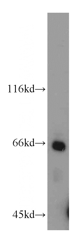 MCF7 cells were subjected to SDS PAGE followed by western blot with Catalog No:111627(IFNAR2 antibody) at dilution of 1:500