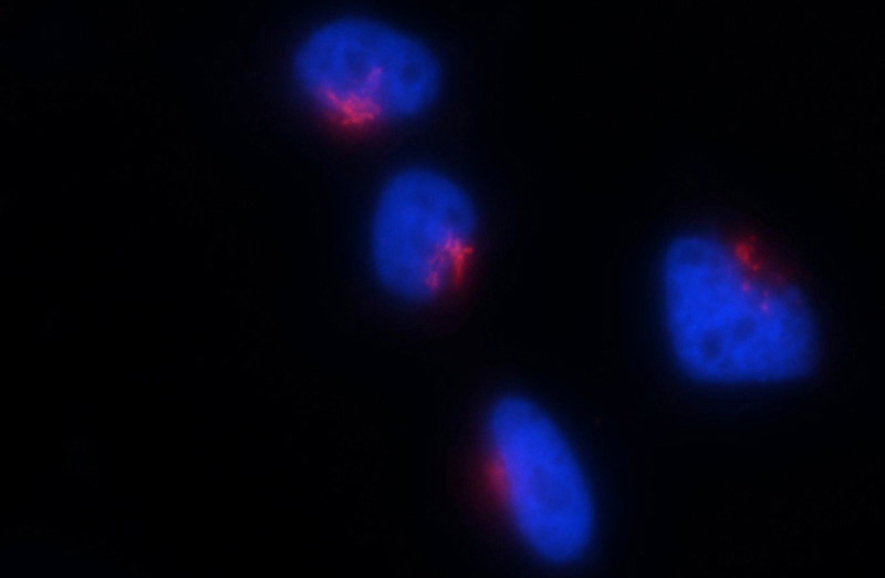 Immunofluorescent analysis of HEK-293 cells using Catalog No:111014(GM130;GOLGA2 Antibody) at dilution of 1:25 and Rhodamine-Goat anti-Rabbit IgG