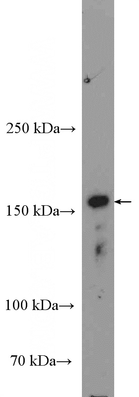 mouse spleen tissue were subjected to SDS PAGE followed by western blot with Catalog No:112475(MAP3K1 Antibody) at dilution of 1:600