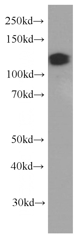 K-562 cells were subjected to SDS PAGE followed by western blot with Catalog No:107419(MCM2 Antibody) at dilution of 1:2000