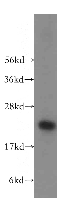 HeLa cells were subjected to SDS PAGE followed by western blot with Catalog No:116371(TSR2 antibody) at dilution of 1:400