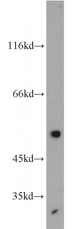 mouse placenta tissue were subjected to SDS PAGE followed by western blot with Catalog No:110306(EDNRB antibody) at dilution of 1:500