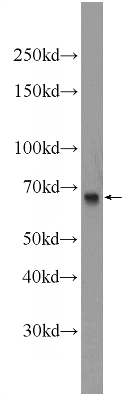 mouse kidney tissue were subjected to SDS PAGE followed by western blot with Catalog No:109931(DHX35 Antibody) at dilution of 1:300