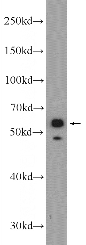 A431 cells were subjected to SDS PAGE followed by western blot with Catalog No:109806(KRT4 Antibody) at dilution of 1:600