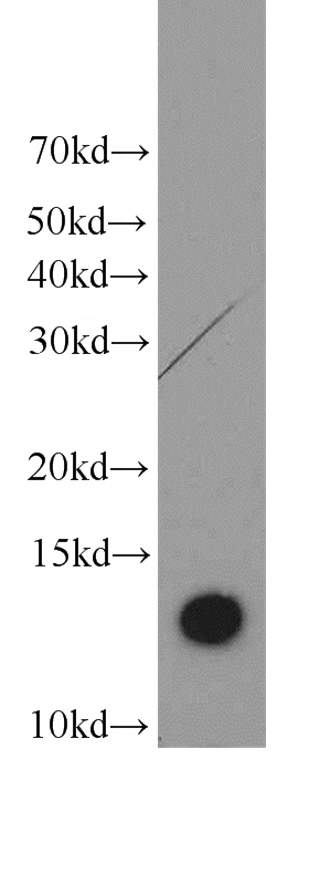 HepG2 cells were subjected to SDS PAGE followed by western blot with Catalog No:108701(C20orf30 antibody) at dilution of 1:1000