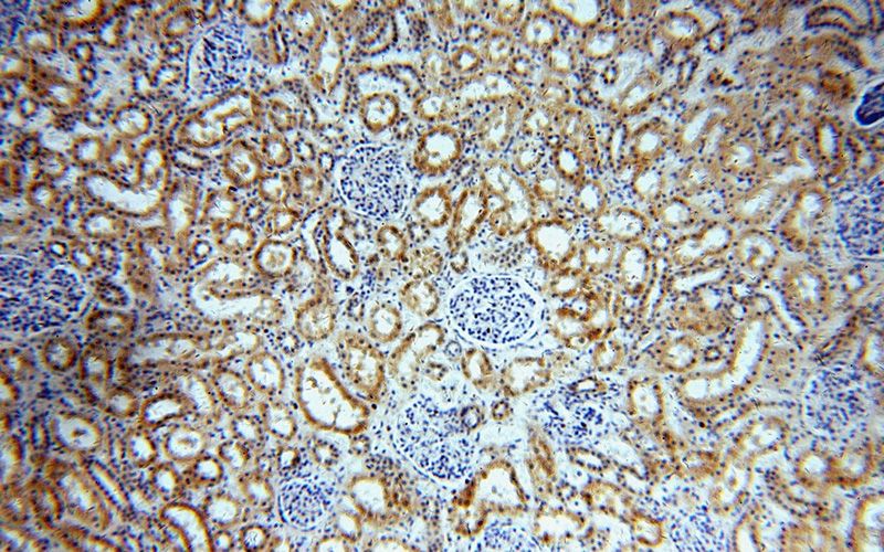 Immunohistochemical of paraffin-embedded human kidney using Catalog No:108966(CCDC158 antibody) at dilution of 1:100 (under 10x lens)