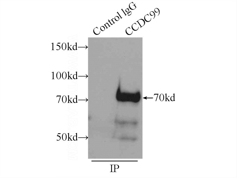 IP Result of anti-CCDC99 (IP:Catalog No:108994, 3ug; Detection:Catalog No:108994 1:1000) with HEK-293 cells lysate 920ug.