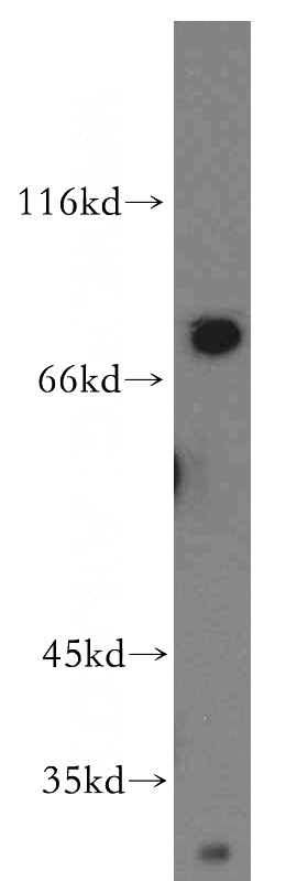 mouse liver tissue were subjected to SDS PAGE followed by western blot with Catalog No:115945(TNXB antibody) at dilution of 1:300