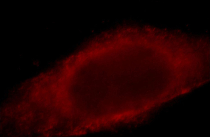 Immunofluorescent analysis of Hela cells, using LDHB antibody 19988-AP at 1:25 dilution and Rhodamine-labeled goat anti-rabbit IgG (red).