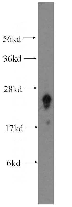 human brain tissue were subjected to SDS PAGE followed by western blot with Catalog No:110586(FAM3C antibody) at dilution of 1:500