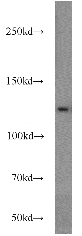 mouse brain tissue were subjected to SDS PAGE followed by western blot with Catalog No:116346(TRAPPC9,NIBP antibody) at dilution of 1:800