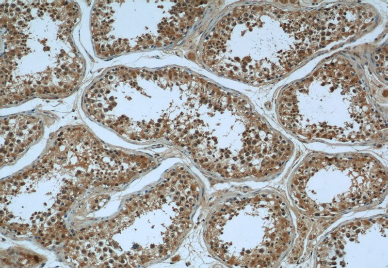Immunohistochemical of paraffin-embedded human testis using Catalog No:112000(KIF15 antibody) at dilution of 1:50 (under 10x lens)