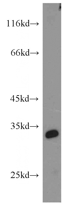 mouse ovary tissue were subjected to SDS PAGE followed by western blot with Catalog No:115535(SPAG7 antibody) at dilution of 1:1000