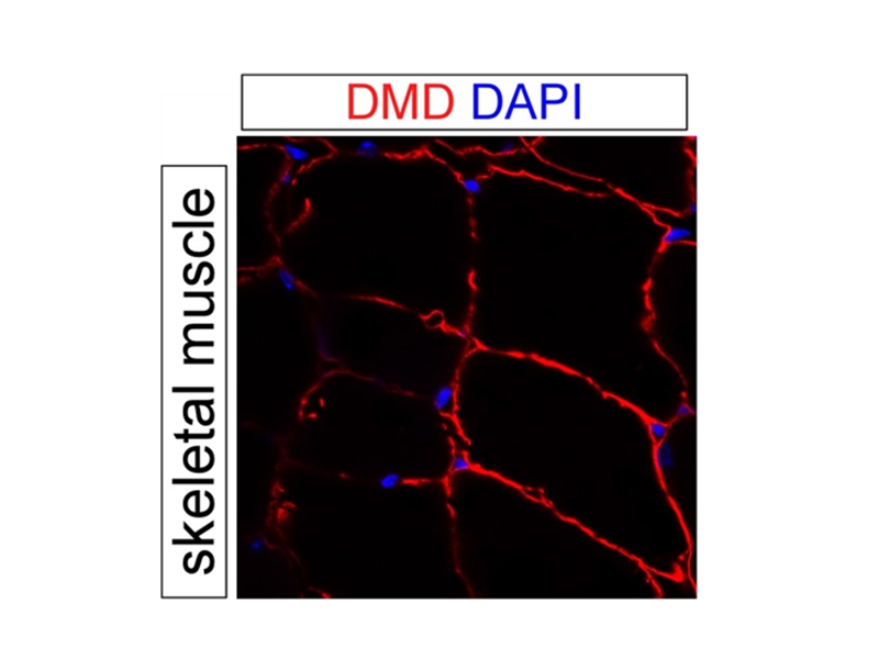 IF result of anti-DMD (Catalog No:110149, 1:500) with PFA fixed mouse skeletal muscle tissue by Dr. Daniel Kopinke.