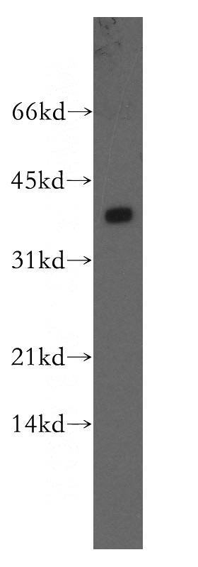 mouse lung tissue were subjected to SDS PAGE followed by western blot with Catalog No:114096(PPP2CB antibody) at dilution of 1:400