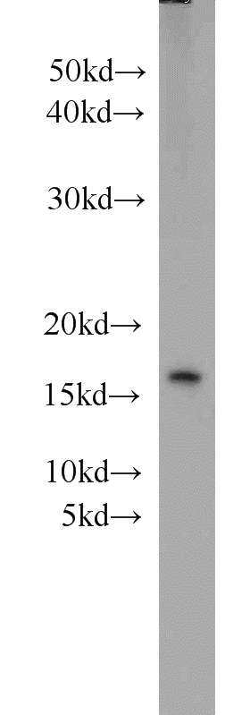 mouse ovary tissue were subjected to SDS PAGE followed by western blot with Catalog No:115859(TAX1BP3 antibody) at dilution of 1:1000