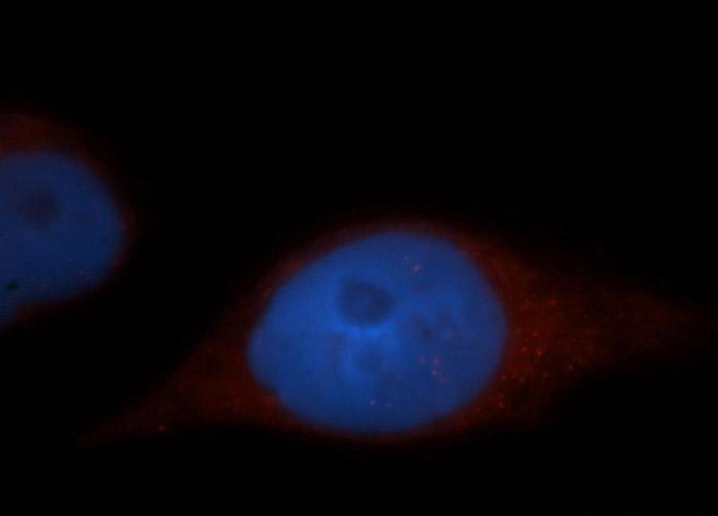 Immunofluorescent analysis of MCF-7 cells, using ADAP1 antibody Catalog No:107772 at 1:50 dilution and Rhodamine-labeled goat anti-rabbit IgG (red). Blue pseudocolor = DAPI (fluorescent DNA dye).
