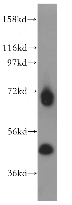 BxPC-3 cells were subjected to SDS PAGE followed by western blot with Catalog No:114603(RBM17 antibody) at dilution of 1:800